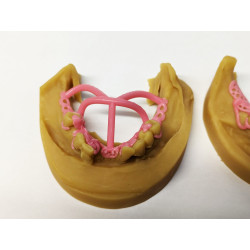 BlueCast BLUE DENTAL CAST LCD/DLP