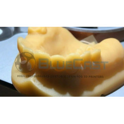 BlueCast LCD DLP Dental Model